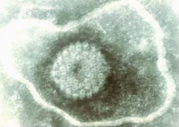 تصویر میکروسکوپ الکترونی از هرپس‌ویروس اسب