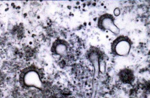مشاهده میکرو کونیدی آسپرژیلوس در بررسی‌های سلول‌شناسی