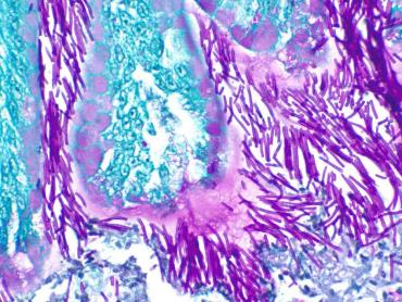 تصویر میکروسکوپی نشانگر رشد قارچ بر سطح اپیتلیوم چینه‌دان تهیه شده با رنگ‌آمیزی PAS